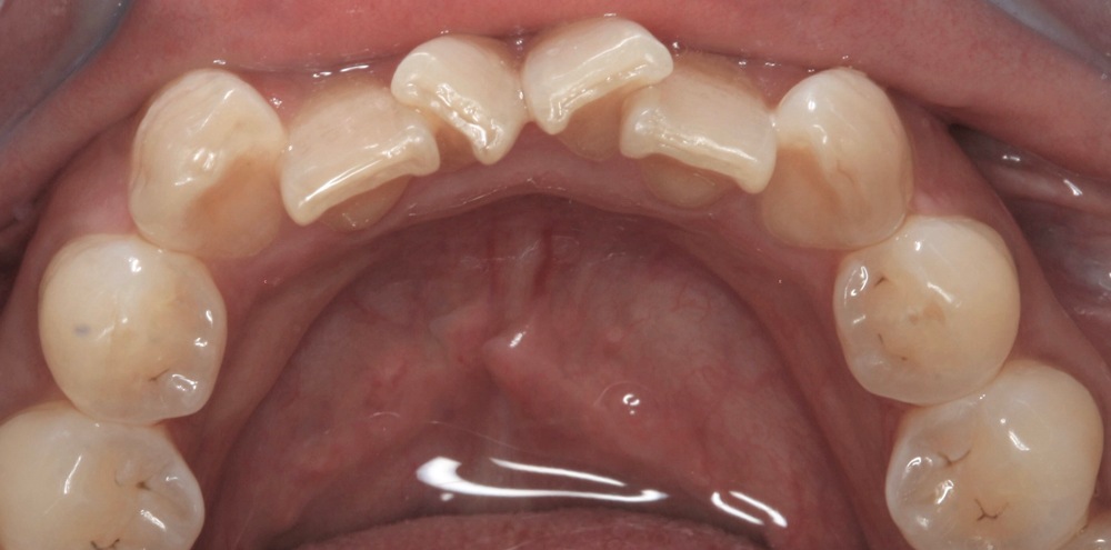 carp dental implants goulborn