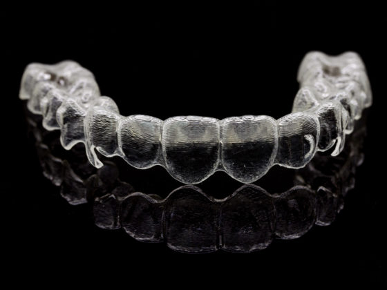 Kanata dental retainers Invisalign clear esthetic aligners