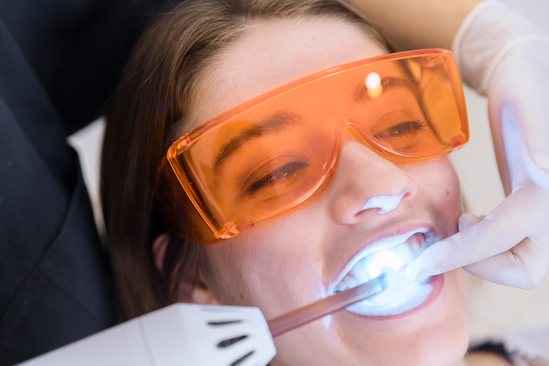 Pros And Cons Of Laser Teeth Bleaching