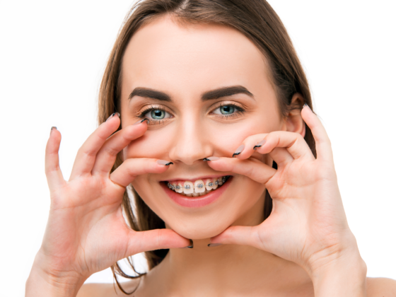 Dunrobin Dentists Carp - Brushing and Oral Hygiene with Brackets Braces