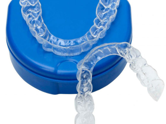 Retainers serve to keep your teeth straight once you have completed your orthodontic treatment - CARLETON PLACE DENTISTS ALMONTE