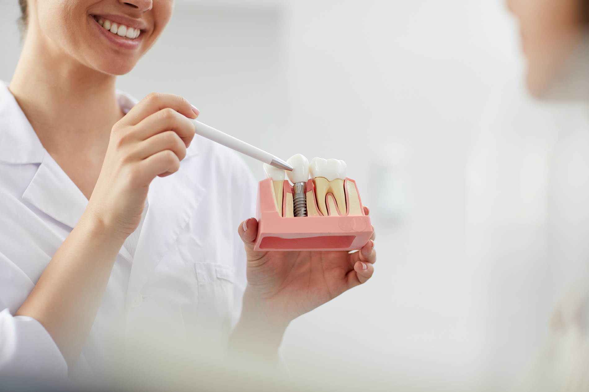 Kanata Implants Dental Teeth