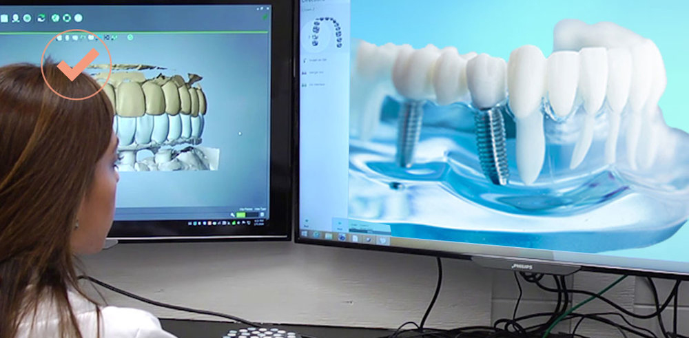 CT scans 3D scanning and 3D printing dental implants